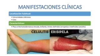 Erisipela Y Celulitis PPT