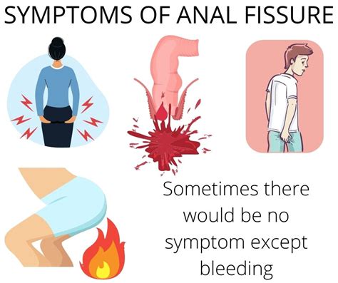 Homeopathic Treatment For Anal Fissures Treatment In Delhi