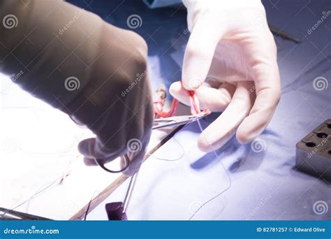 Knee Tendon Ligament Surgery Stock Photo | CartoonDealer.com #82245108