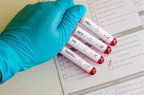 Private Sexual Health Testing Sti Testing Privatemedical Clinic