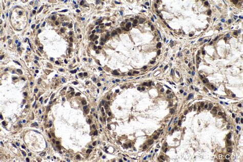 Mettl Antibody Rr Proteintech