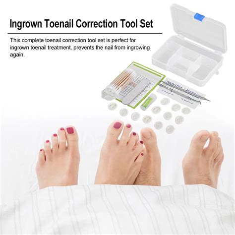 Foot Care Toenail Correction Tool Set Ingrown Toenail Treatment Toenail ...