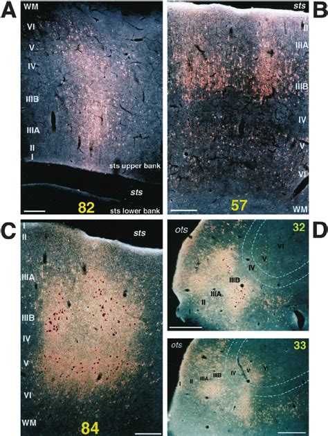 Dark Field Photomicrographs Showing The Laminar Distribution Of Labeled