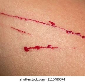 Hand Cut Blood Images, Stock Photos & Vectors | Shutterstock