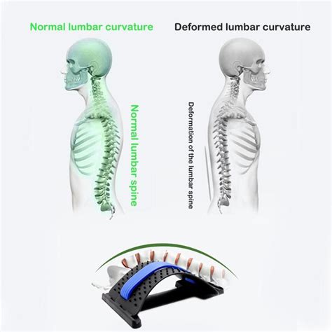 Back Stretching Machine l Spine Stretcher Equipment – Balma Home