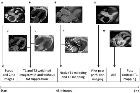 Mri Protocol Different Images Of Cardiac Myxomas During Cardiac