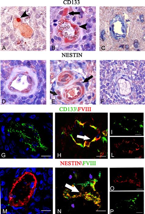 Cd133 And Nestin Immunohistochemistry A F And Cd133 Green Fviii