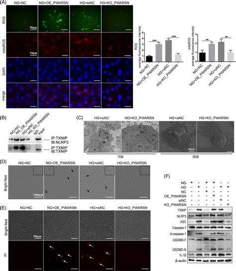 PWARSN Triggers TXNIP NLRP3induced Pyroptosis Of Tubular Epithelial