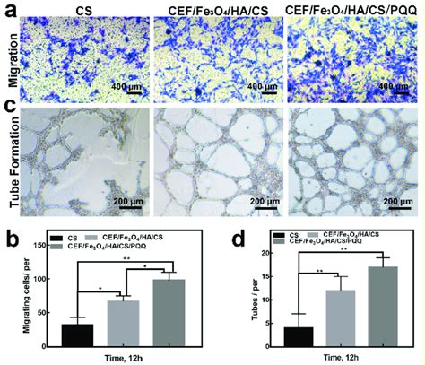 Effects Of Different Groups On HUVECs A Migration Of Cells Between