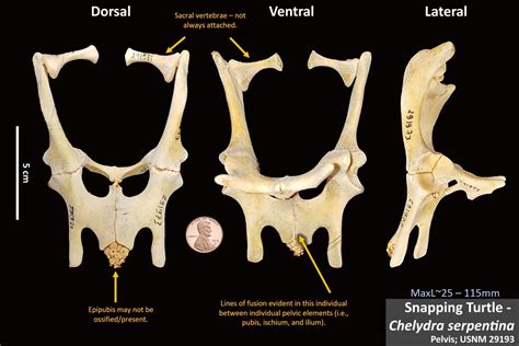 Bones Osteoid Bone Identification