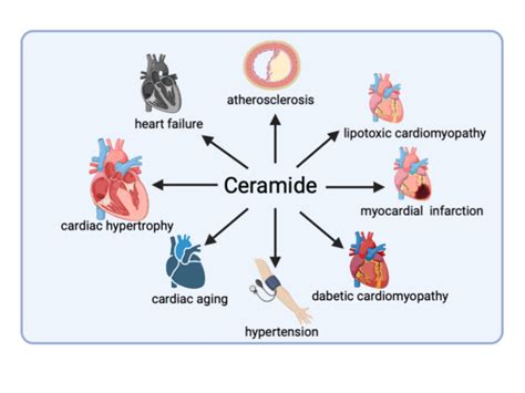 Emerging Roles Of Ceramide In Cardiovascular Diseases Abstract