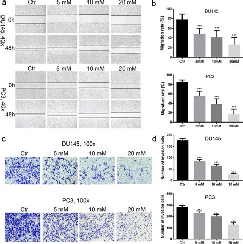 Metformin Reduced The Migration And Invasion Of AR Negative Prostate