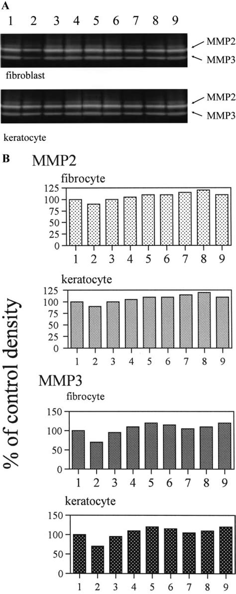 Detection Of MMP 2 And MMP 3 By Zymography Enzyme Activities Of MMP 2