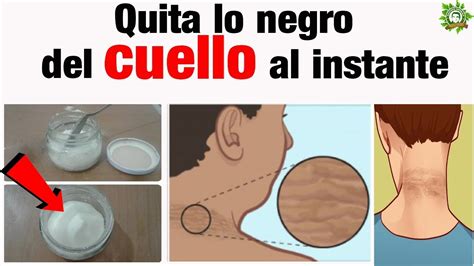 Como Aclarar El Cuello Negro Executivegetty