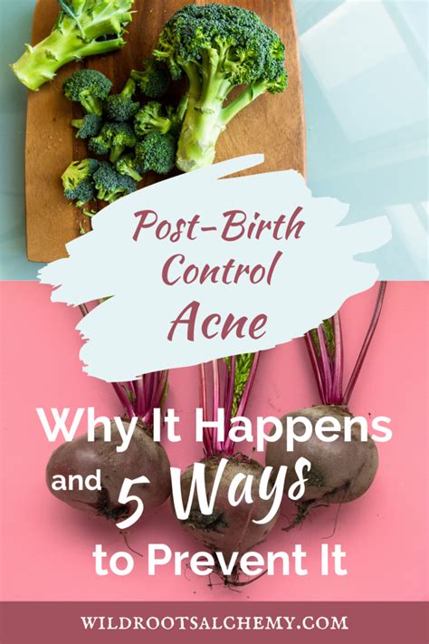 Post-Birth Control Acne: Why It Happens and 5 Ways to Prevent It - Wild Roots Alchemy