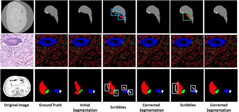 Semi Automatic Medical Image Annotation