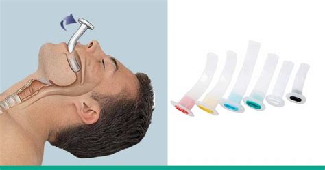 Oropharyngeal Airway Guedel Airway Or Oral Airway Opa How To Use