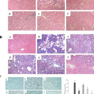 TPEP Alleviated CCl 4 Induced Liver Histopathologic Architecture In