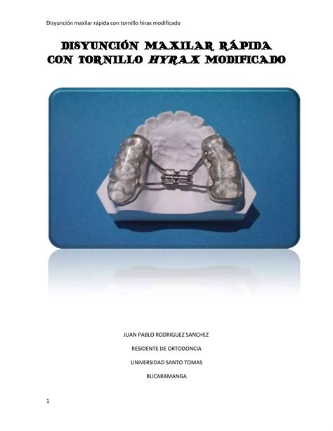 Disyunción maxilar rápida con tornillo hyrax modificado PDF