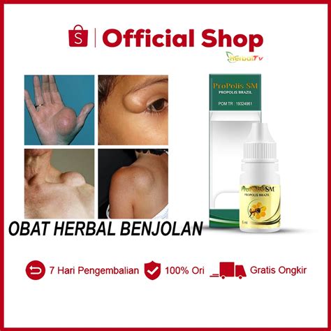 Jual Obat Herbal Untuk Menghancurkan Berbagai Benjolan Di Tubuh Leher