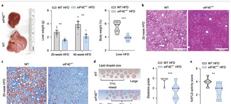 科学网—代谢学人 寒期合集｜2021年nature Metabolism代谢研究大合集 徐凌燕的博文