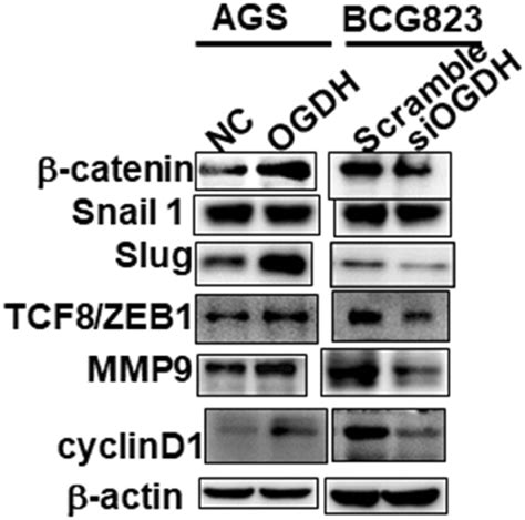 OGDH modulates β catenin signaling Representative Western blot