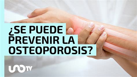 Se Puede Prevenir La Osteoporosis Imss Emite Recomendaciones Youtube