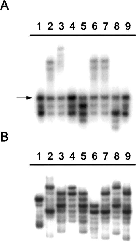 Genetic Anthropology Of The Colorectal CancerSusceptibility Allele APC