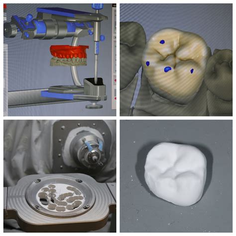 Cadcam Schlee Dental