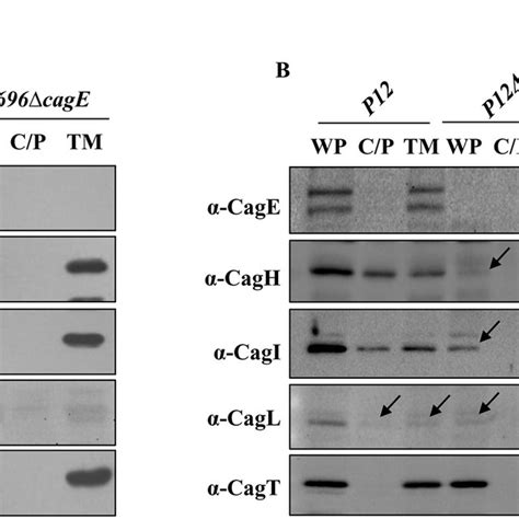 A Western Blots Showing Sub Cellular Localisation Of Pilus Associated