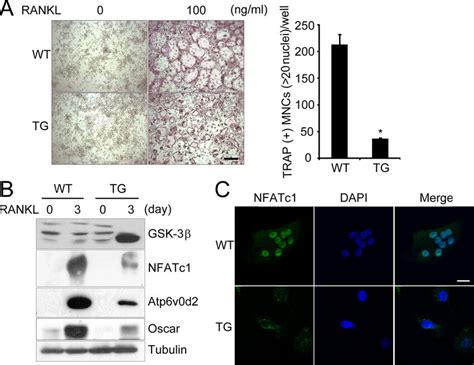 Impaired Osteoclastogenesis And NFATc1 Induction In BMMs Of Tg Mice