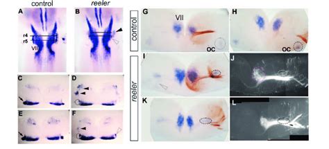 Positioning Of Olivocochlear OC Precursors Is Affected In Reeler