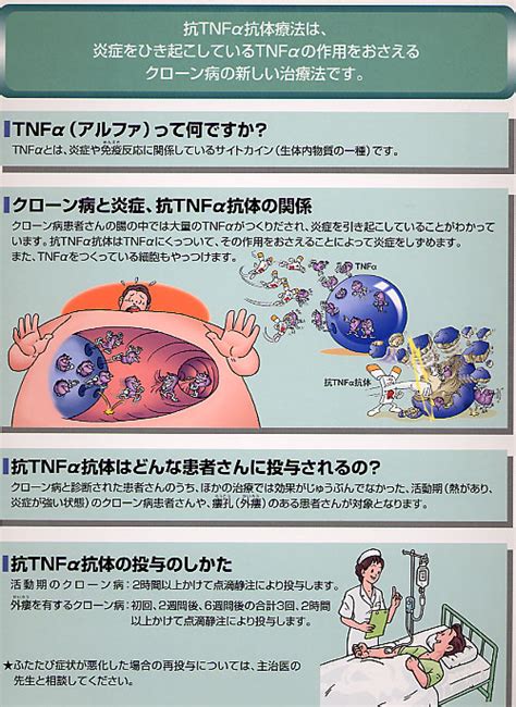 薬物療法 クローン病に対するレミケード療法｜高野病院