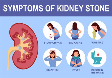 Kidney Stones: Symptoms And Treatment Options - Ask The Nurse Expert