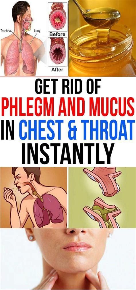 Get Rid Of Phlegm And Mucus In Chest Throat Instantly Getting Rid