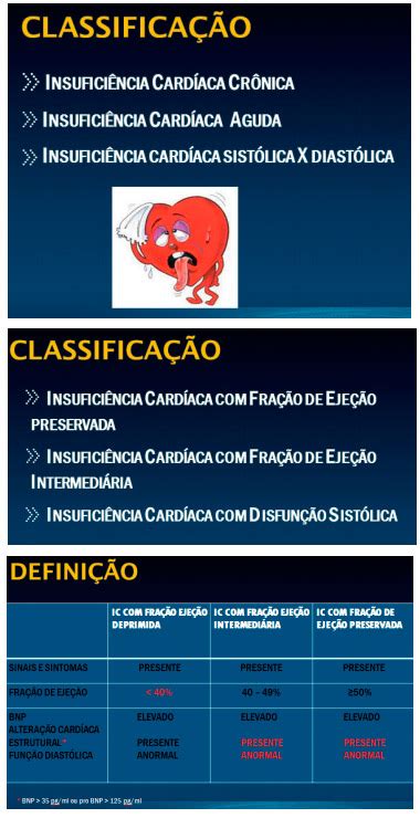 Insuficiência cardíaca definição classificação sintomas e principais