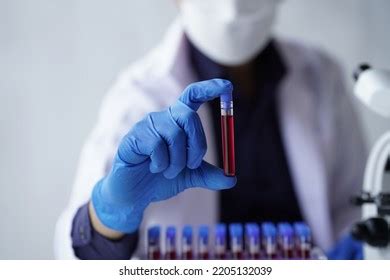 Lab Worker Preparing Test Blood Detection Stock Photo 2205132039