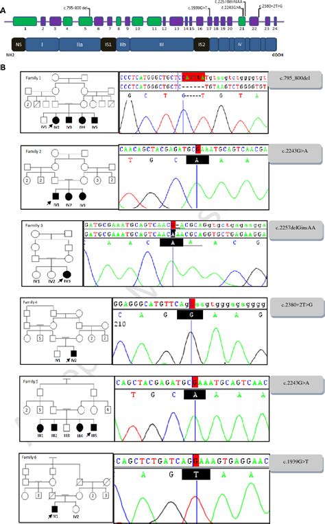 Figure 1 From Report Of Limb Girdle Muscular Dystrophy Type 2a In 6