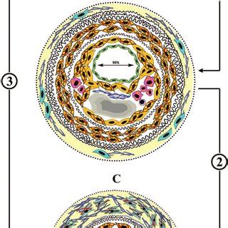 Figure. Role of adventitia in arterial remodeling. A, In the normal ...