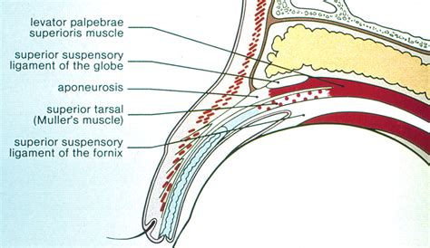 Ptosis Practical Neurology