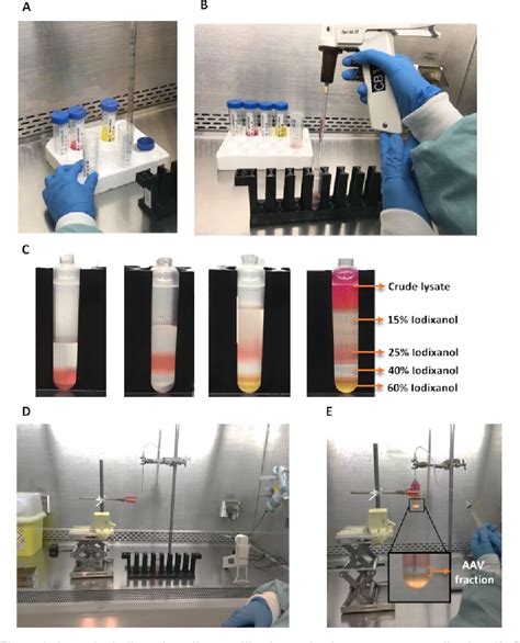 Figure 1 From Production Purification And Quality Control For Adeno Associated Virus Based