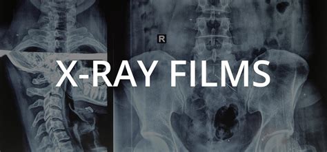 X Ray Films Edusoft HealthCare Pvt Ltd