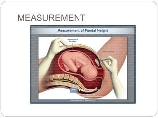 Measuring Of Fundal Height Pptx