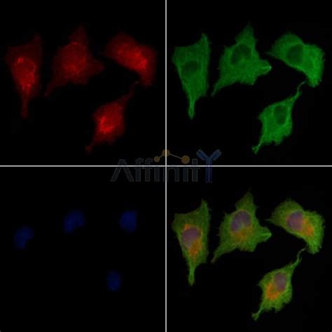 Abca1 Antibody Affinity Biosciences Ltd亲科生物官网