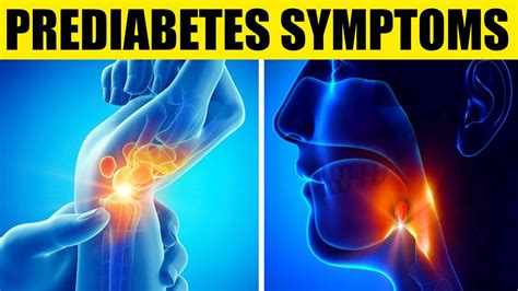 Top 7 Prediabetes Symptoms And Treatment You Need To Know Now Youtube