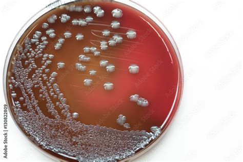 Bacterial culture growth on Blood agar Gram negative bacilli 素材庫相片