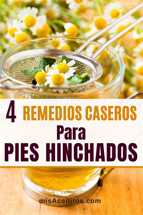 Los Mejores Remedios Para Pies Hinchados Caseros Y Naturales