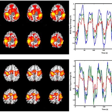 Example Of Bold Functional Magnetic Resonance Imaging Activation Maps Download Scientific