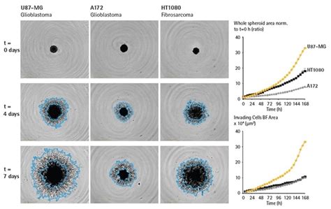 3d Tumor Spheroid Invasion Monitoring With Live Cell Analysis