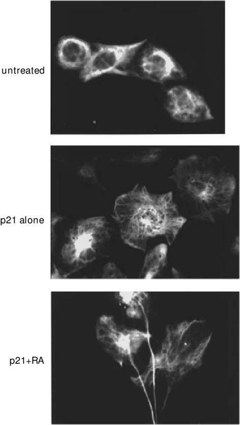 Rearrangement Of Gfap In Cki Expressing U343 Cells U343 Cells Download Scientific Diagram